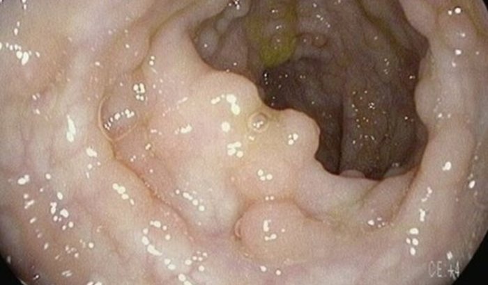 TODOS POR FABRINI - CIRURGIA URGENTE