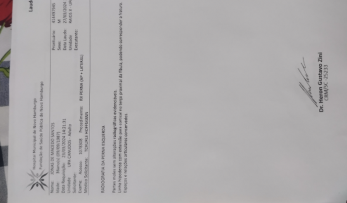 Cirurgia de prótese do fêmur