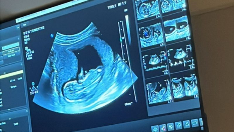 Preciso de Ajuda com o Enxoval do Meu Bebê! 