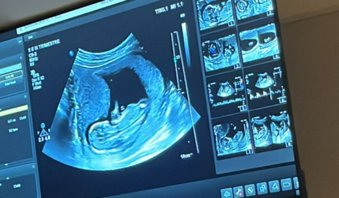 Preciso de Ajuda com o Enxoval do Meu Bebê! 