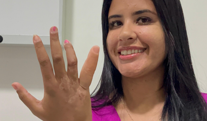 Ajuda para comprar um dedinho