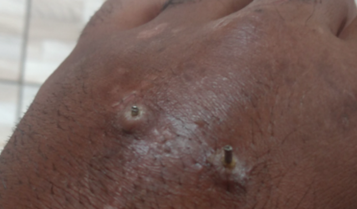 Ajuda para voltar a trabalhar 