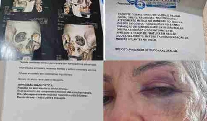 Ajude na cirurgia facial da Francisca 