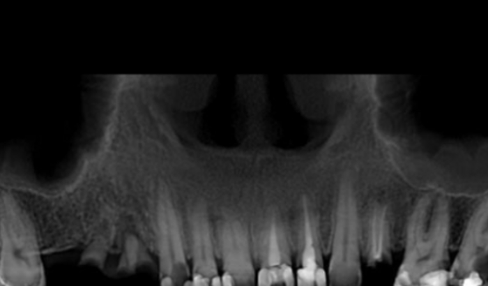 Tratamento odontológico