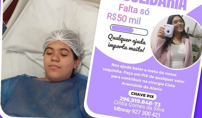 Cirurgia de Cisto Aracnóide