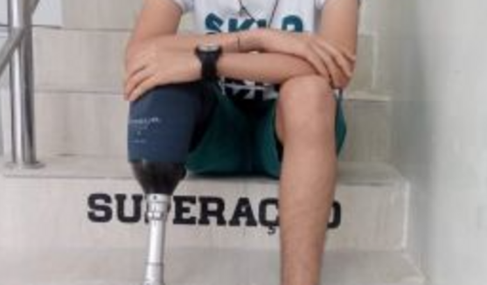 Ajude a Moisés a comprar a prótese da perna