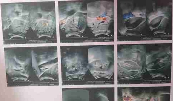 Pedir a ajuda de vcs pra meu pai que se encontrar com um problema no fígado 