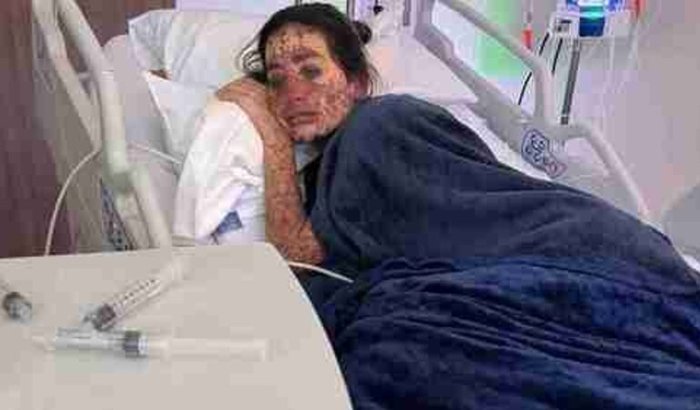 Juntos pela Alê – A Guerra Ainda Não Acabou!