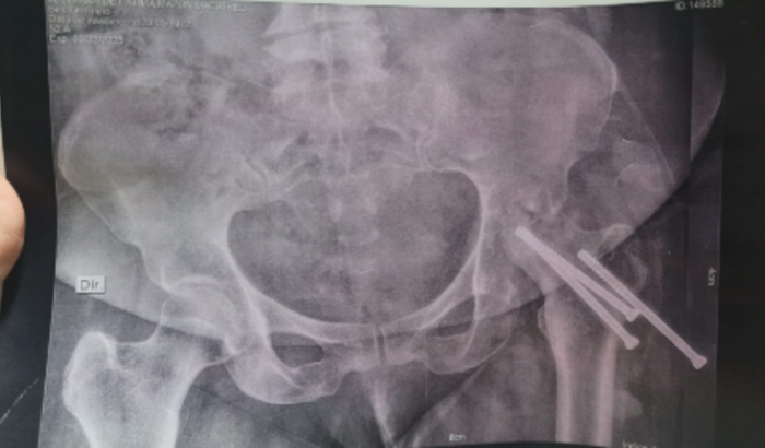 Cirurgia da minha mãe - Jucimara