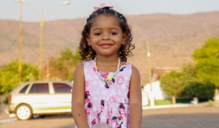 Cirurgia da Pequena Emanuelly 