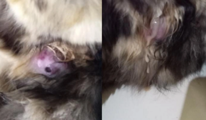 operação para retirada de tumor