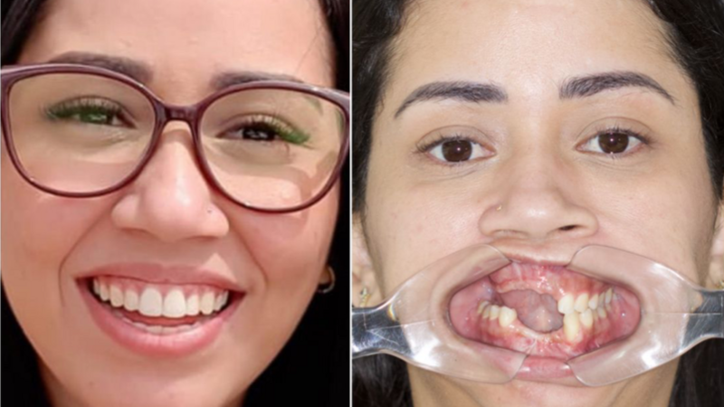 Vamos ajudar a Mari!