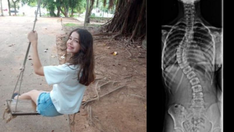 Ajuda para a cirurgia da Alice
