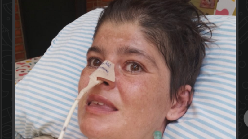 Ajuda para tratamento de AVC Hemorrágico