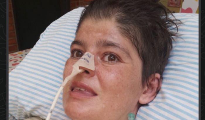 Ajuda para tratamento de AVC Hemorrágico