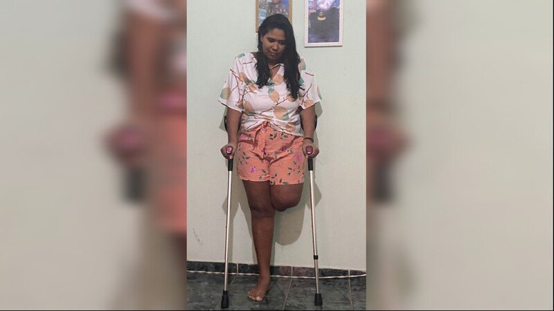 Ajude Patrícia a Caminhar Novamente: Prótese Necessária!