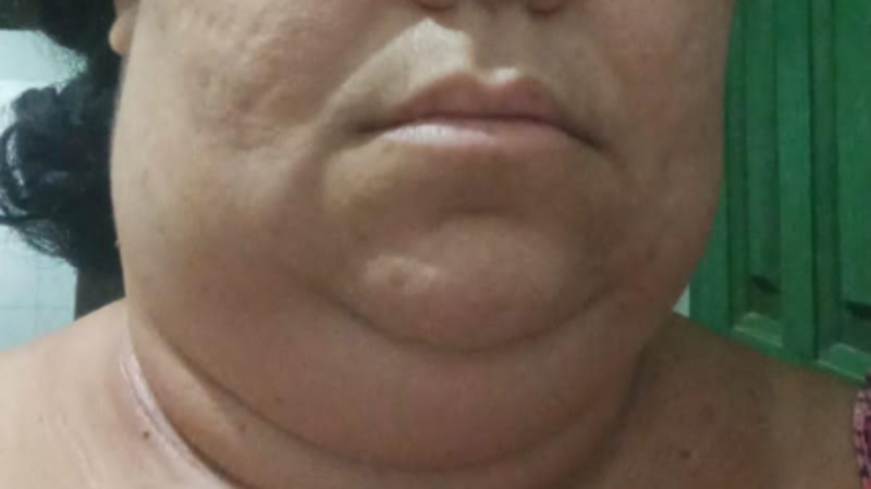 Ajude a Danúbia Azevedo na Luta Contra o Linfoma de Hodgkin