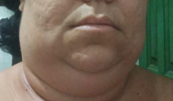 Ajude a Danúbia Azevedo na Luta Contra o Linfoma de Hodgkin