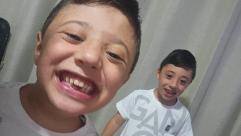 Cirurgia dos gêmeos  de crânio 