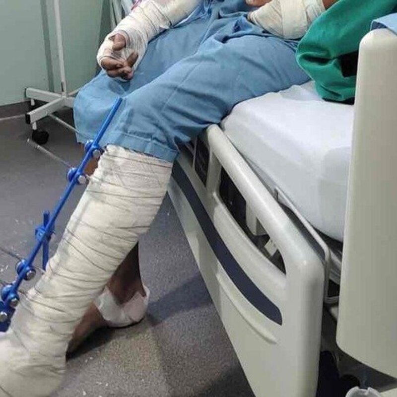 Ajude o Vitor (JAPA)