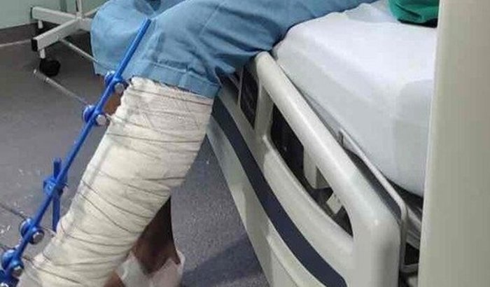 Ajude o Vitor (JAPA)