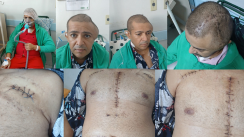 Ajuda no tratamento do Alexandro Medrado Souza