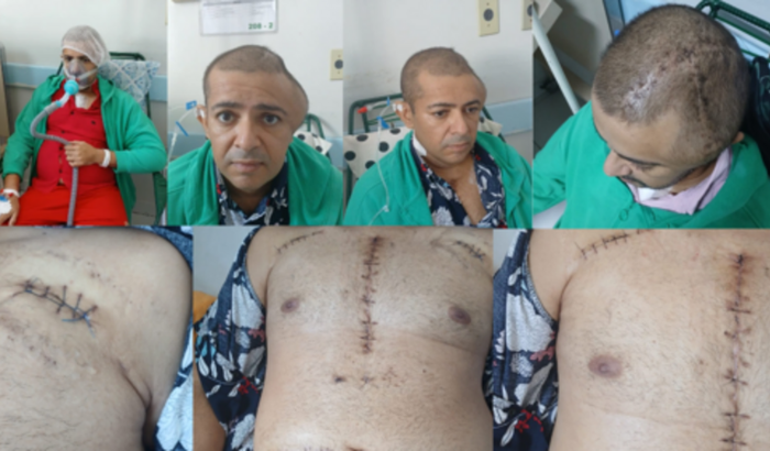 Ajuda no tratamento do Alexandro Medrado Souza