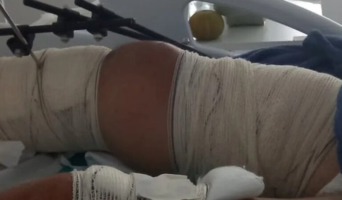 Ajuda para pagar despesas e cirurgia
