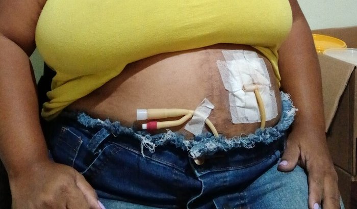 Ajuda no tratamento 