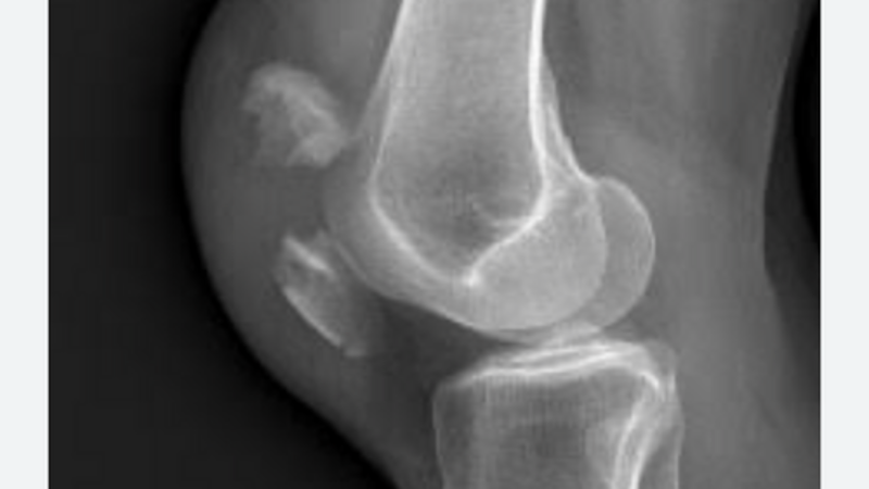 Cirurgia ortopédica 