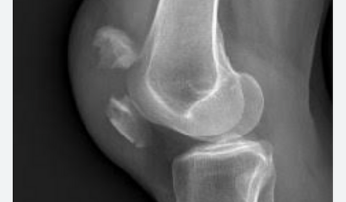 Cirurgia ortopédica 