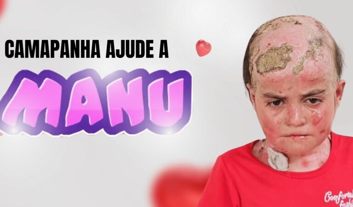 Ajude no tratamento da pequena Manu!
