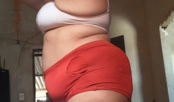 Saindo da obesidade mórbidas 