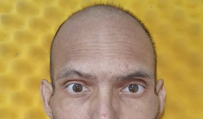 Ajuda para saúde de câncer 
