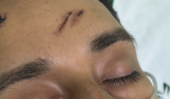  ME AJUDE NA CIRURGIA 