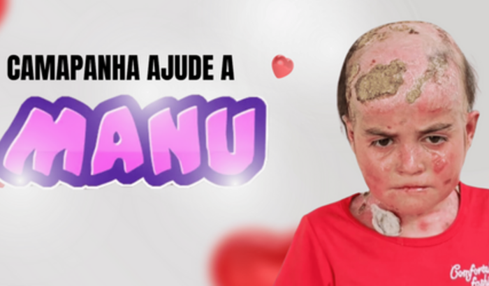 Ajude no tratamento da pequena manu!