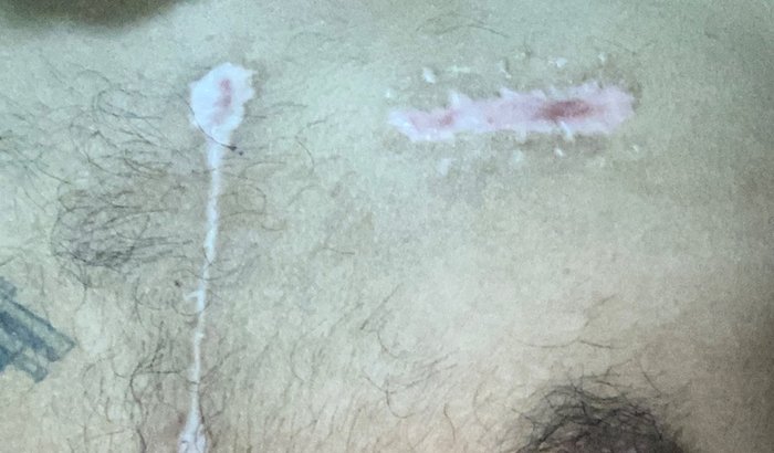 Ajude a minha recuperação 