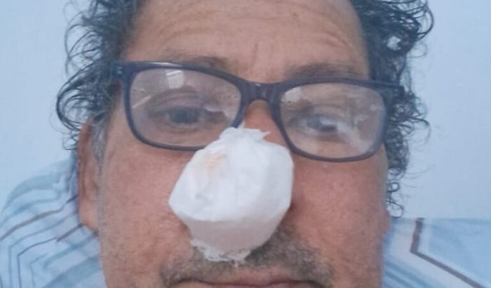 Ajude o Ugeninelson na luta contra o câncer / hidroadenocarcinoma 