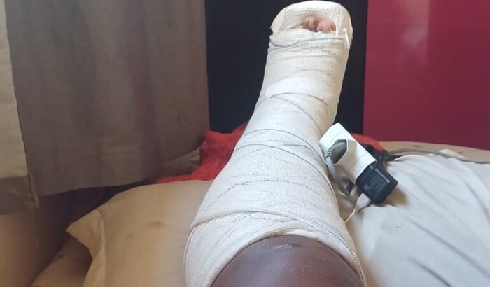 Ajudar comprar comida e pagar exames após um acidente de moto enquanto estava trabalhando de moto Uber 