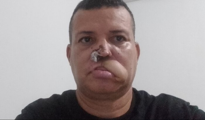 Fazer uma cirurgia plástica 