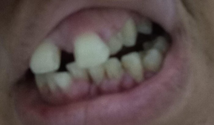 Ajuda com o sorriso 