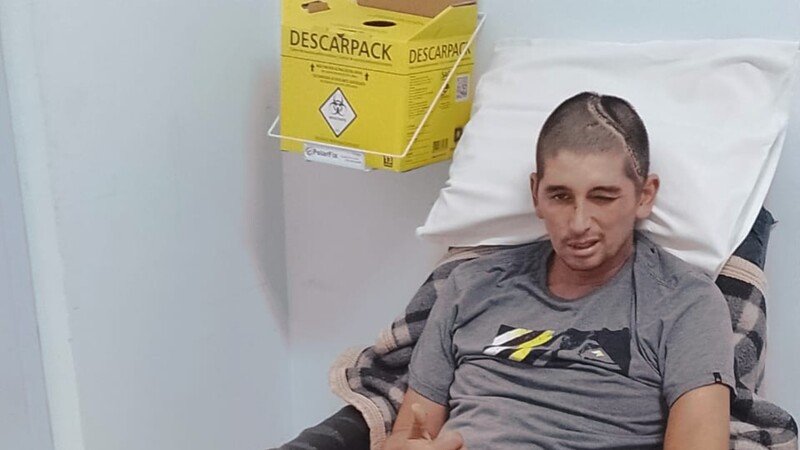 Reabilitação do Bruno 