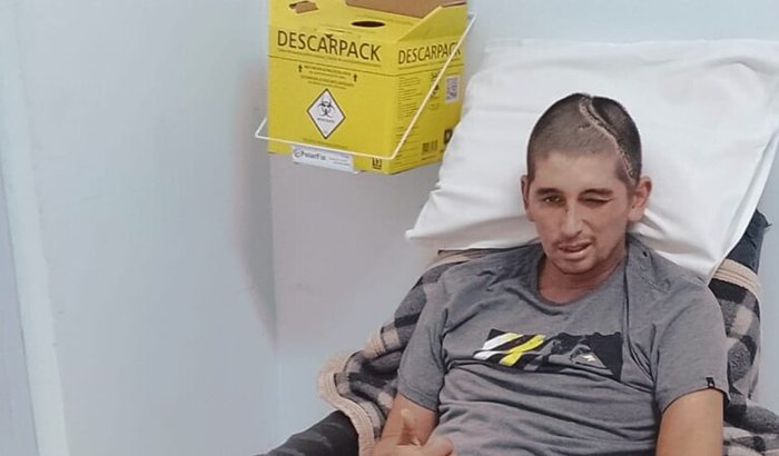 Reabilitação do Bruno 