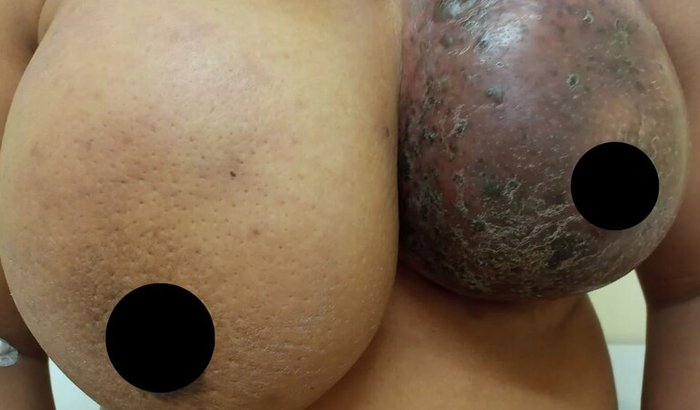 Ajuda para Júlia 