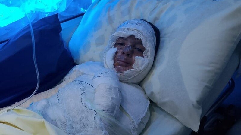 Ajuda no tratamento do Davi