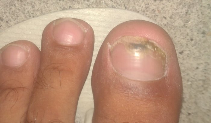 Recuperação 