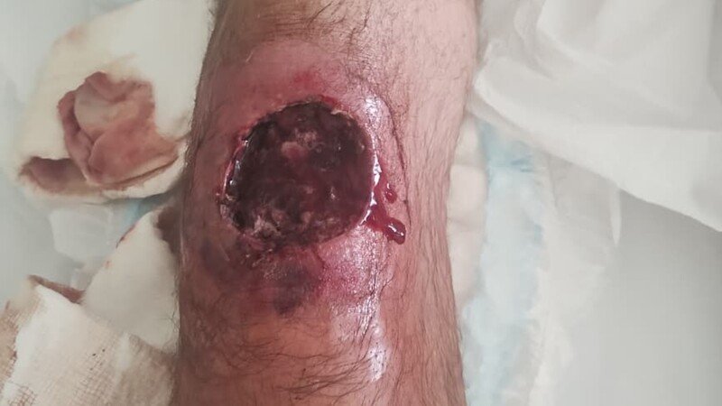 imagem da vaquinha Erro MÉDICO 