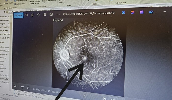 Ajude o teacher Junio a não perder a visão 