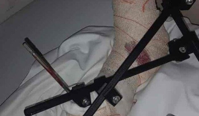 AJUDE NA RECUPERAÇÃO DO RENAN