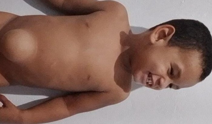 Ajude nós na  Cirurgia do Bernado (beeh )
